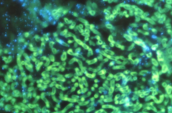 Aspergilus fungi under microscope