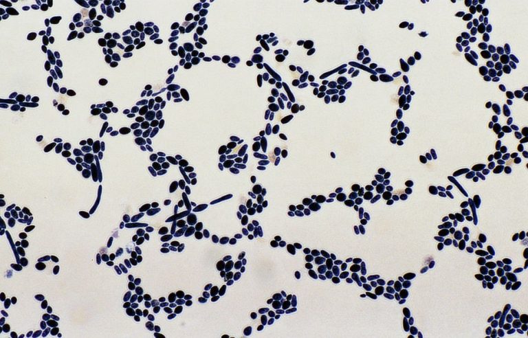 Yeast under microscope