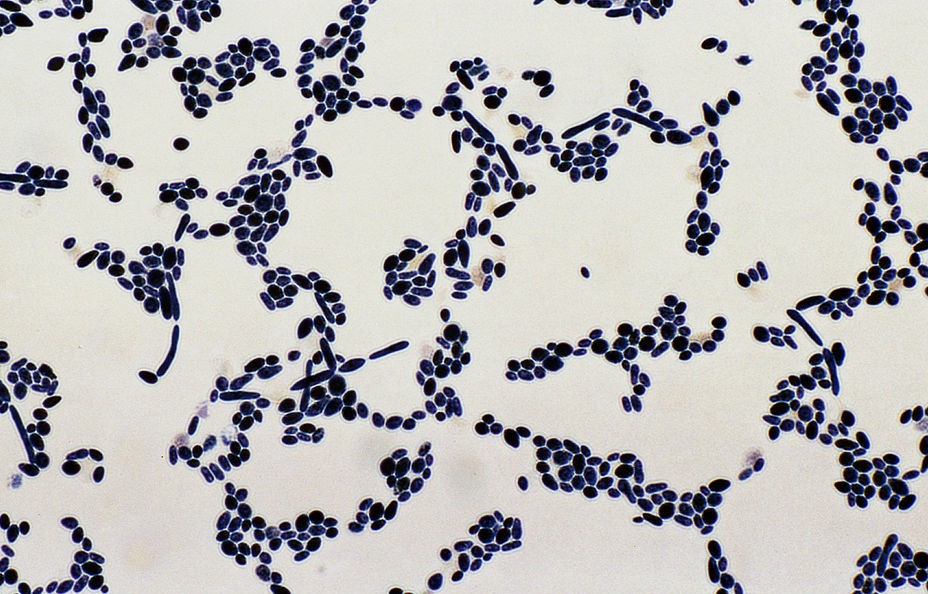 Yeast under microscope